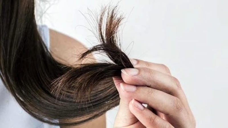 Anomalie acquisite del fusto dei capelli
